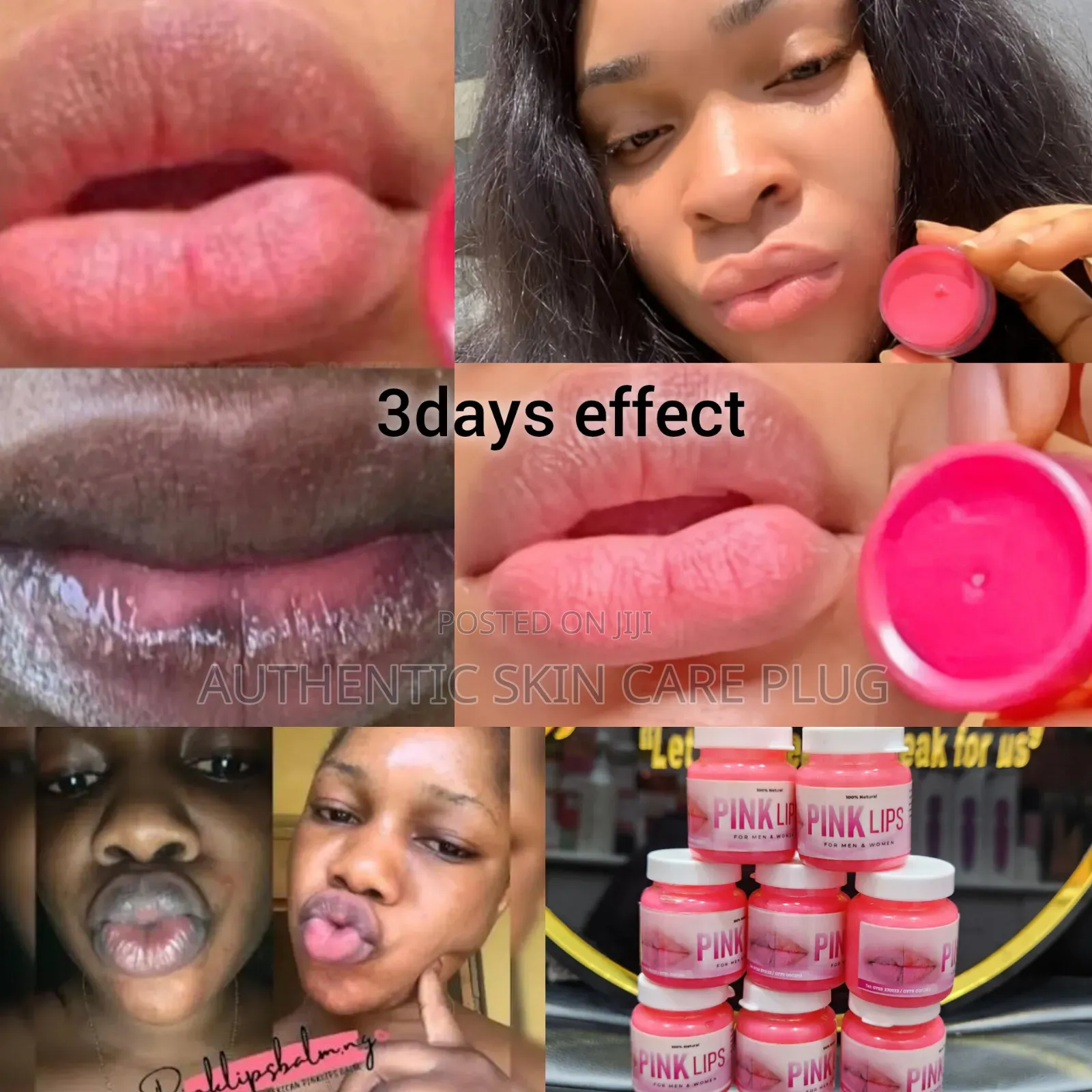 Original Pink Lips Cream for Both Men and Women 10g 3days Results