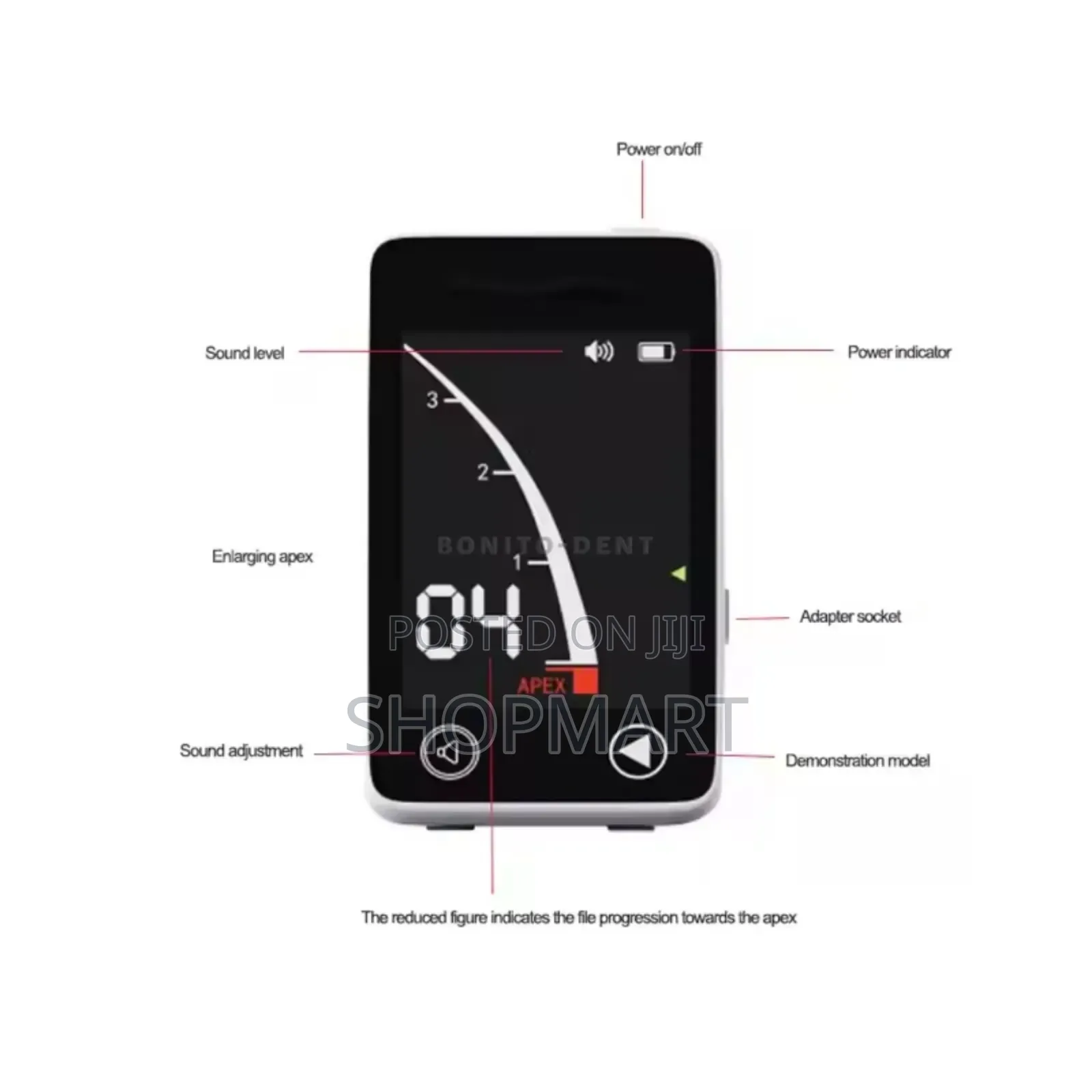 Apex Locator