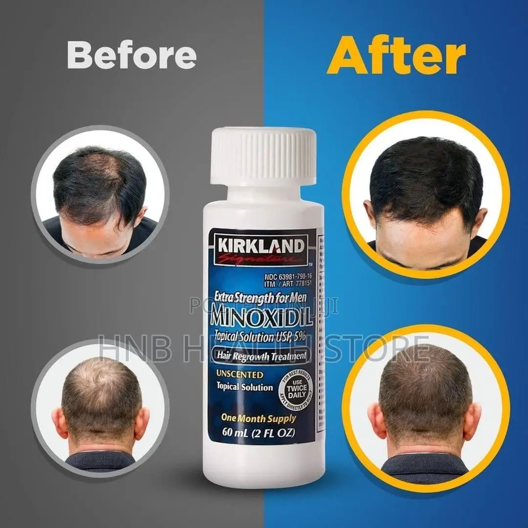 Kirkland Minoxidil Hair Growth Oil.