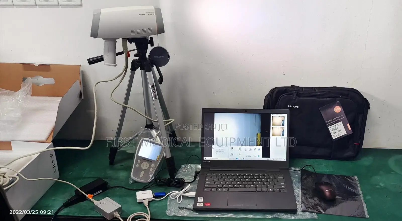 Handheld Video Colposcope-High Quality Imaging