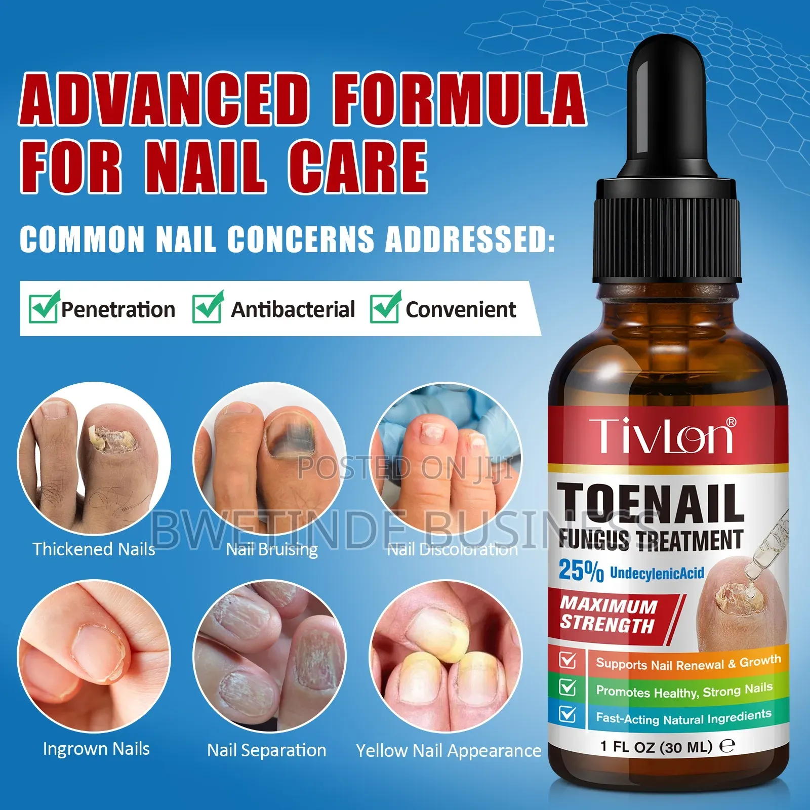 Toe Nail Fungus Treatment Solution