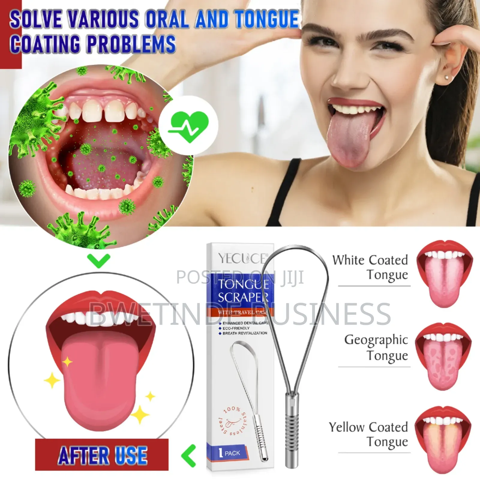 Tongue Scraper