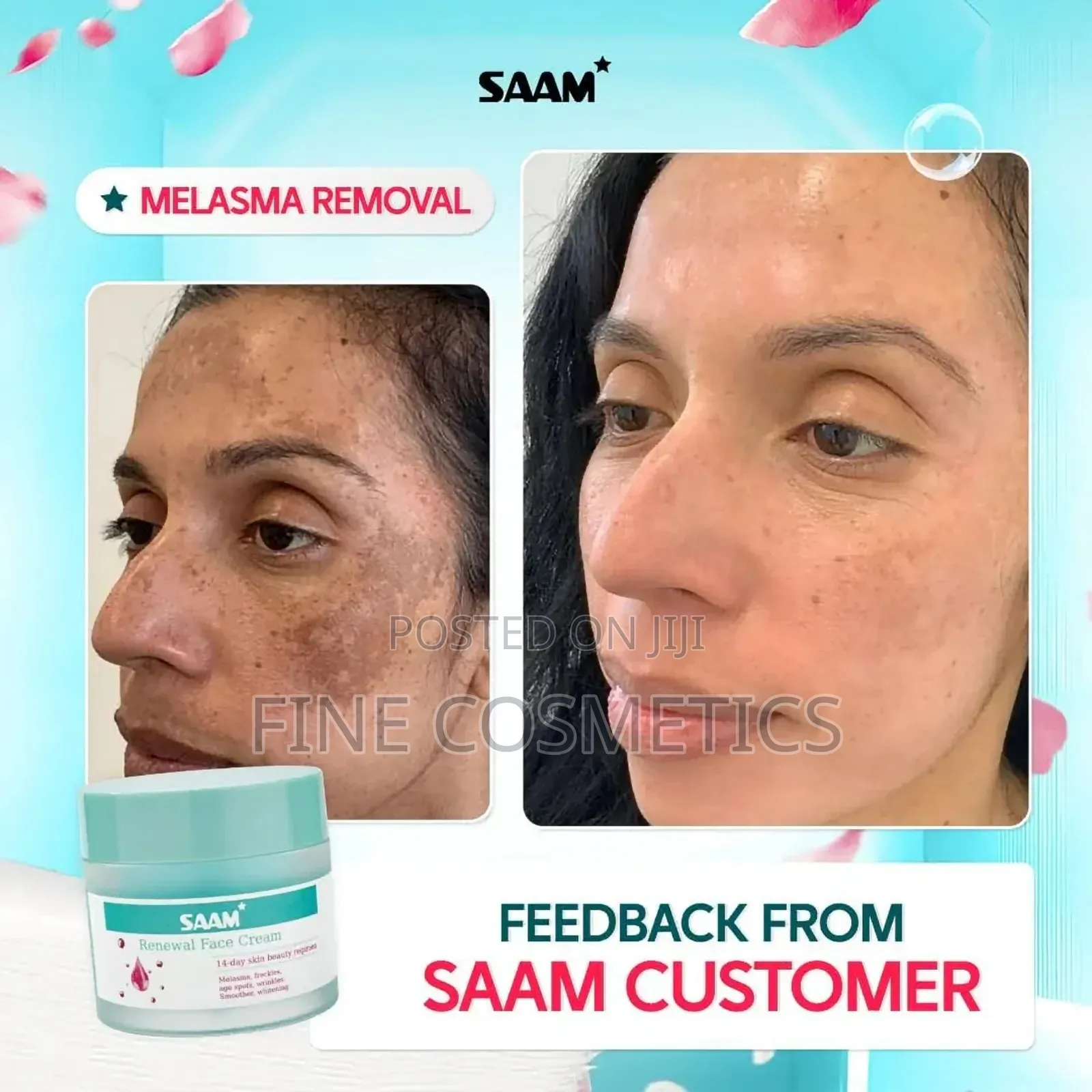 Saam Renewal Face Cream, 14days Skin Beauty Regimen for Skin Blemishes