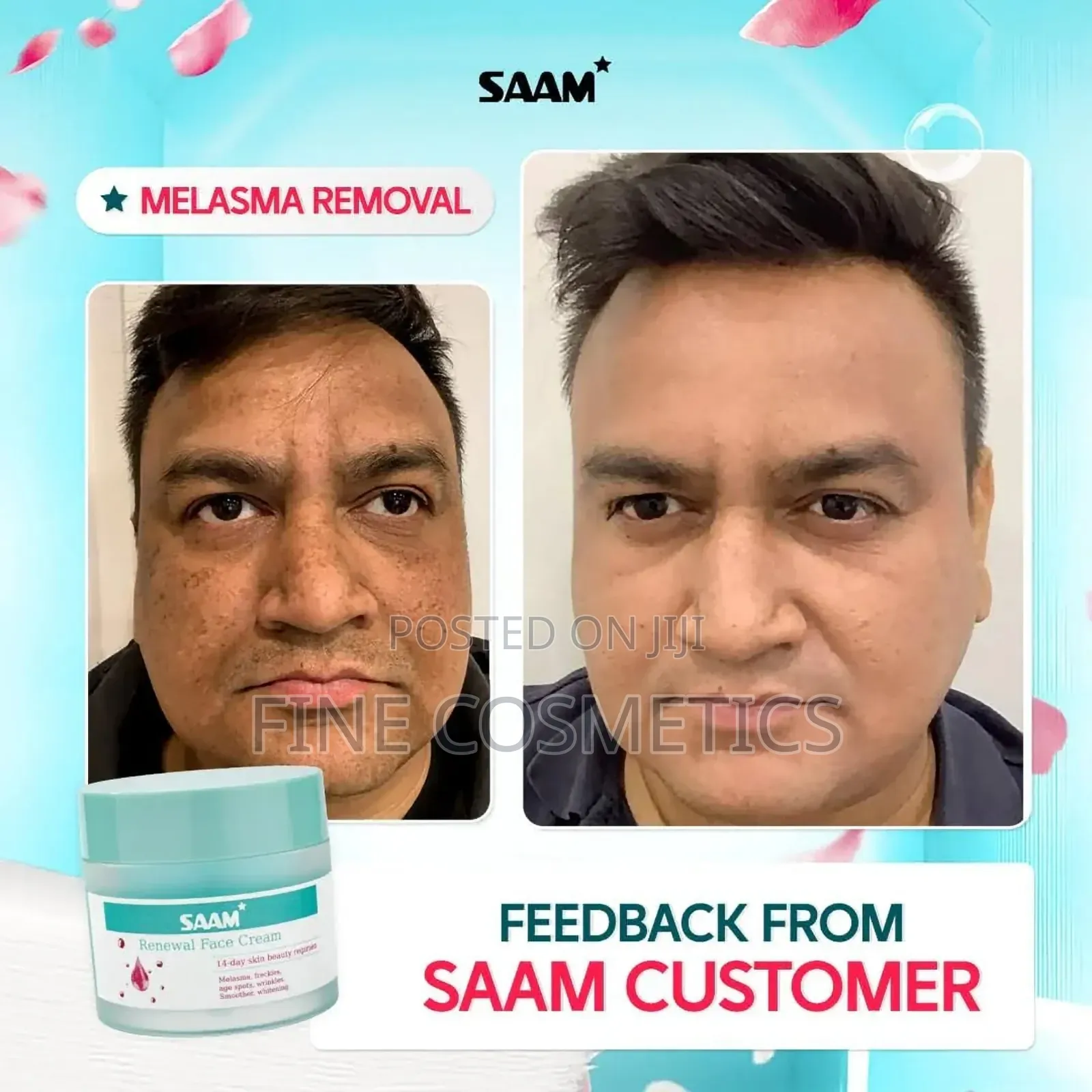 Saam Renewal Face Cream, 14days Skin Beauty Regimen for Skin Blemishes