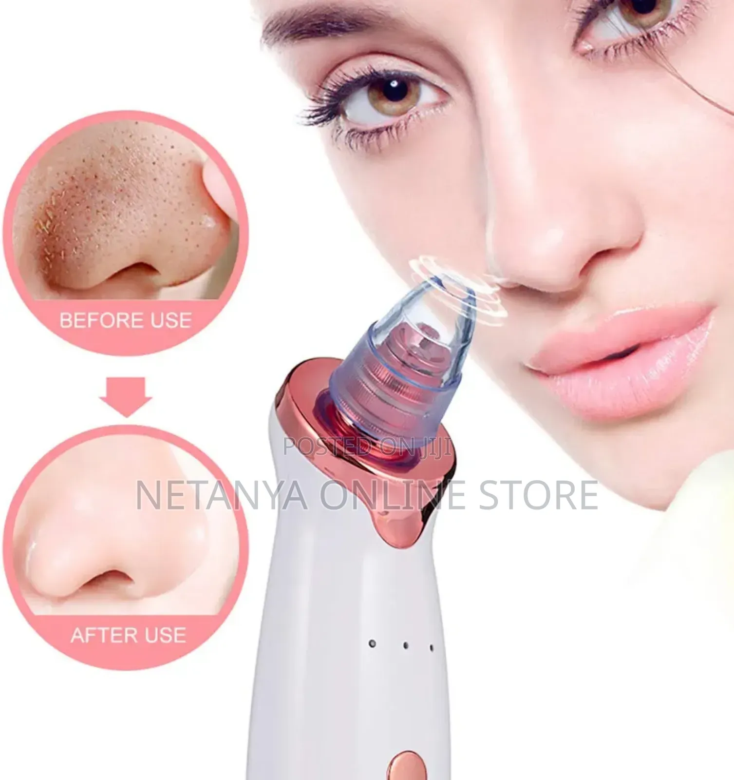 Black Head Acne Remover