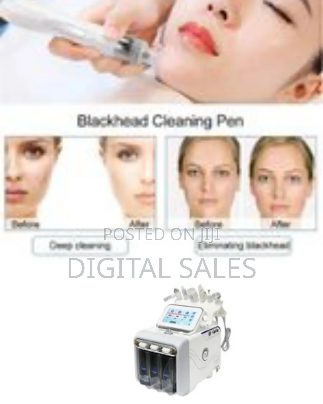 Hydrogen Oxygen Facial Machine, 7 In 1 Professional Diamond Microderma