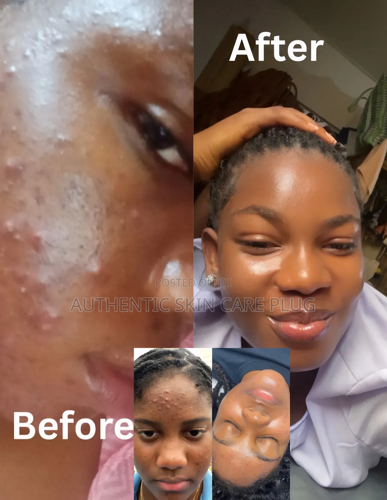 Skin Treatment Soap