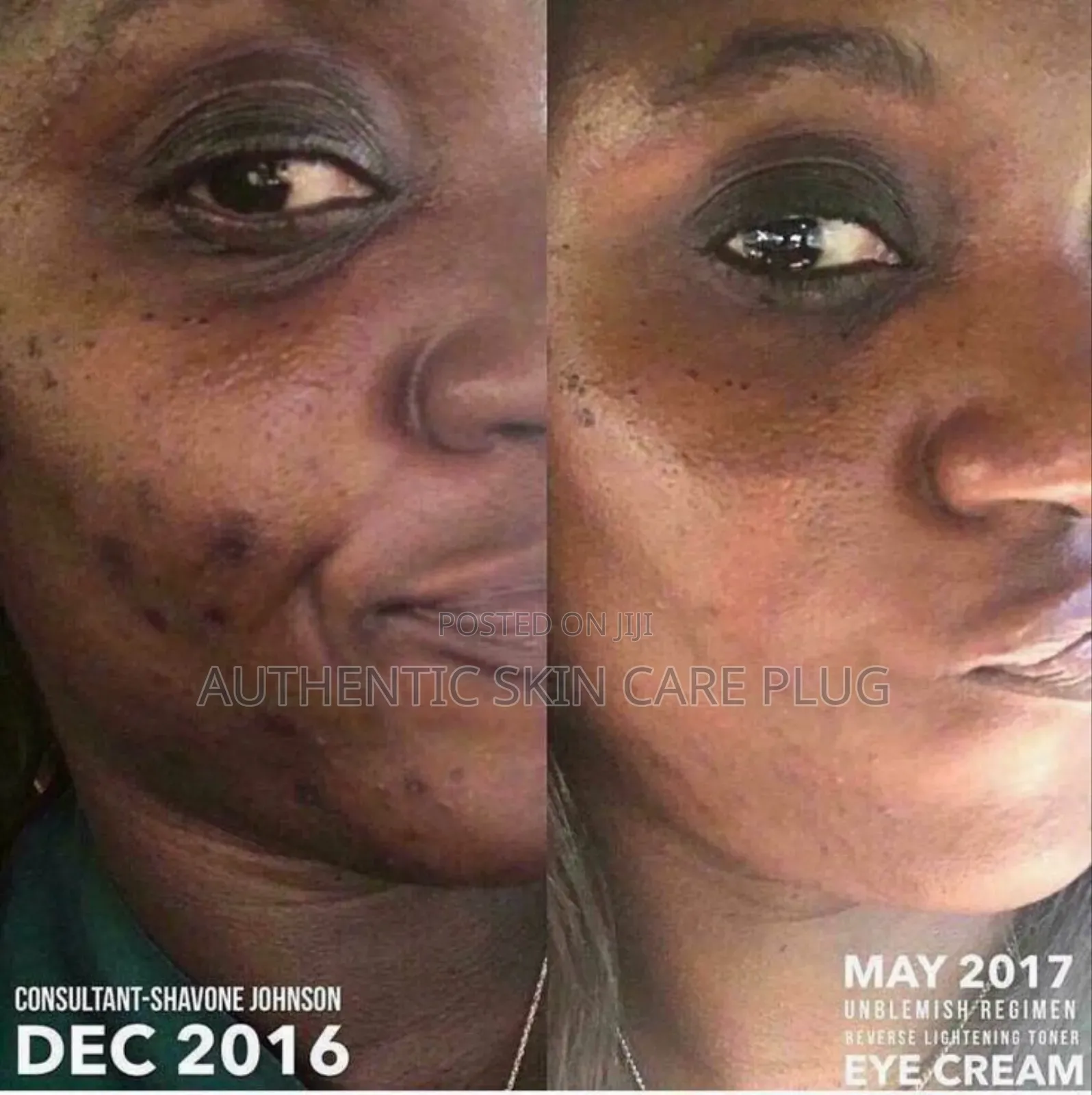 Skin Treatment Soap