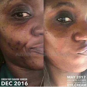 Skin Treatment Soap