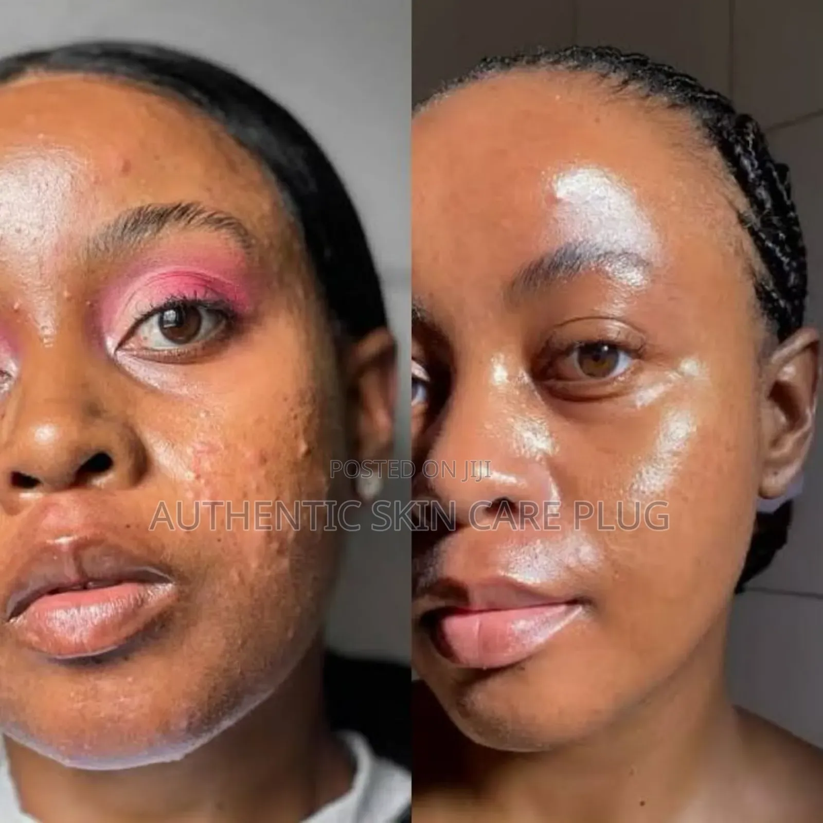 Skin Treatment Soap
