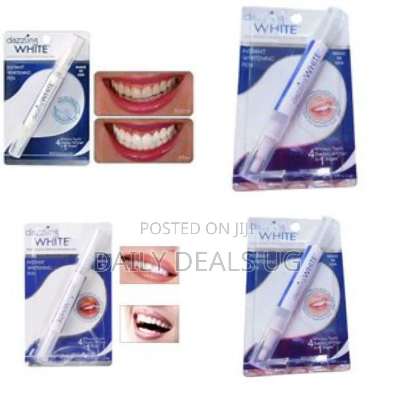 Dazzling White Instant Teeth Whitening Pen, 4 Shades Whiter in a Week