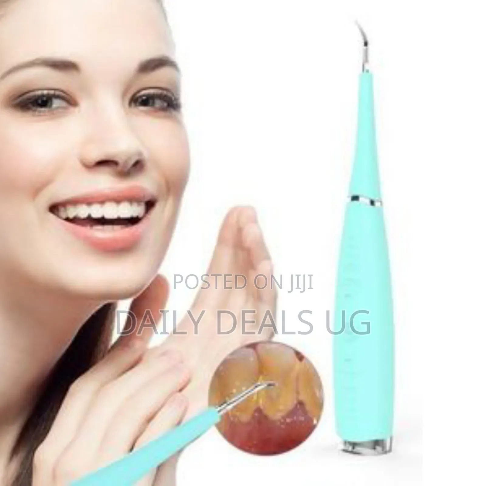 Electric Sonic Dental Calculus Remover