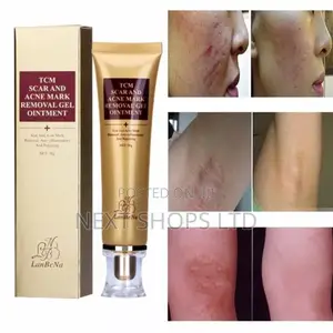 Scar Remover Ointment/ Scar Remover Cream/Scars Removal