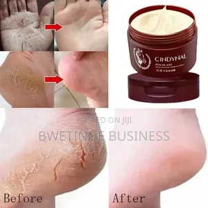 Foot Crack Repair Cream