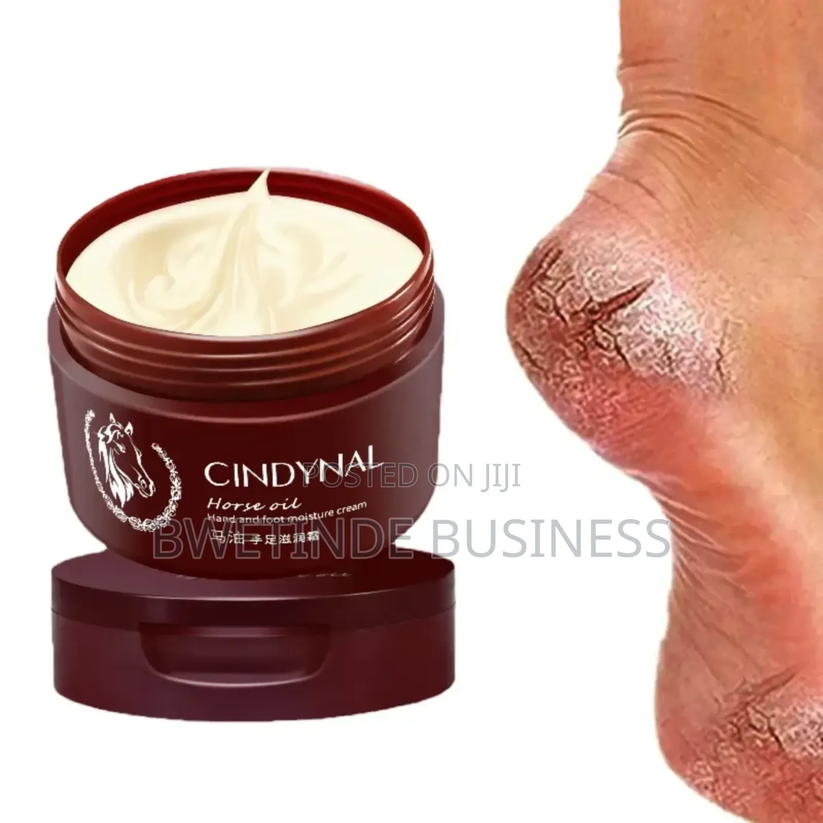 Foot Crack Repair Cream