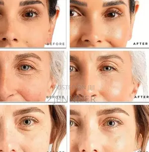 Instant Wrinkle Remover Face Cream