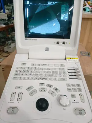 Portable Ultrasound Scan- Mindray Dp 3300