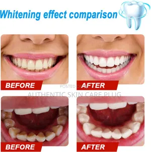 Original Efero Teeth Whitening Serum Gel - Effective Liquid