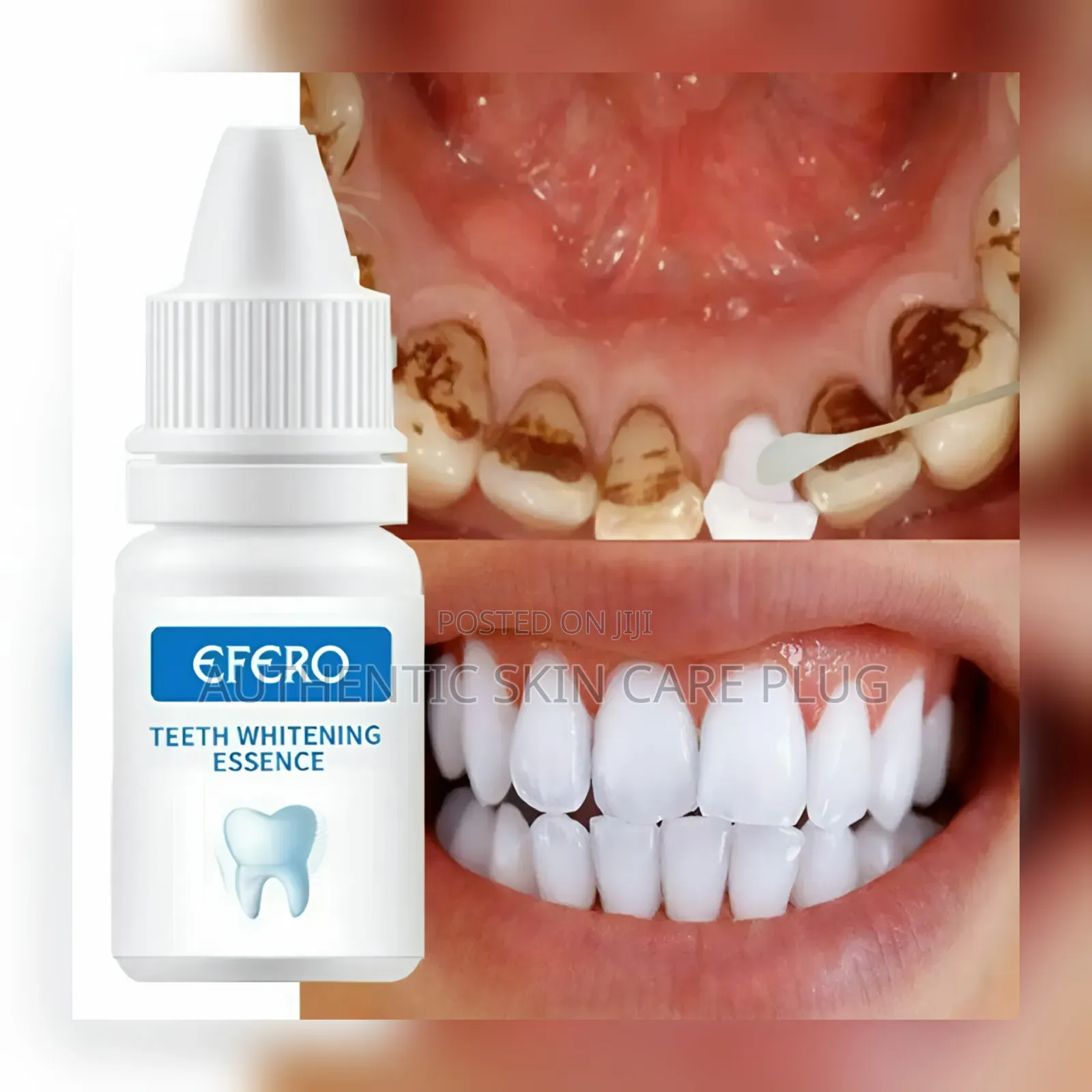 Original Efero Teeth Whitening Serum Gel - Effective Liquid