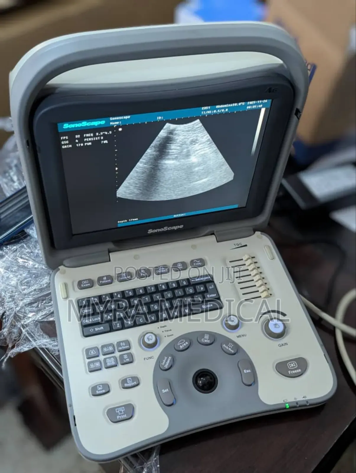 Sonoscape A6 Ultrasound Scan