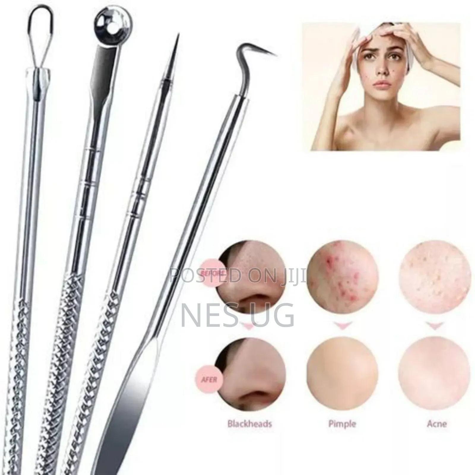 4pcs Stainless Facial Acne Remover Needles Kit Extractor Tool Set