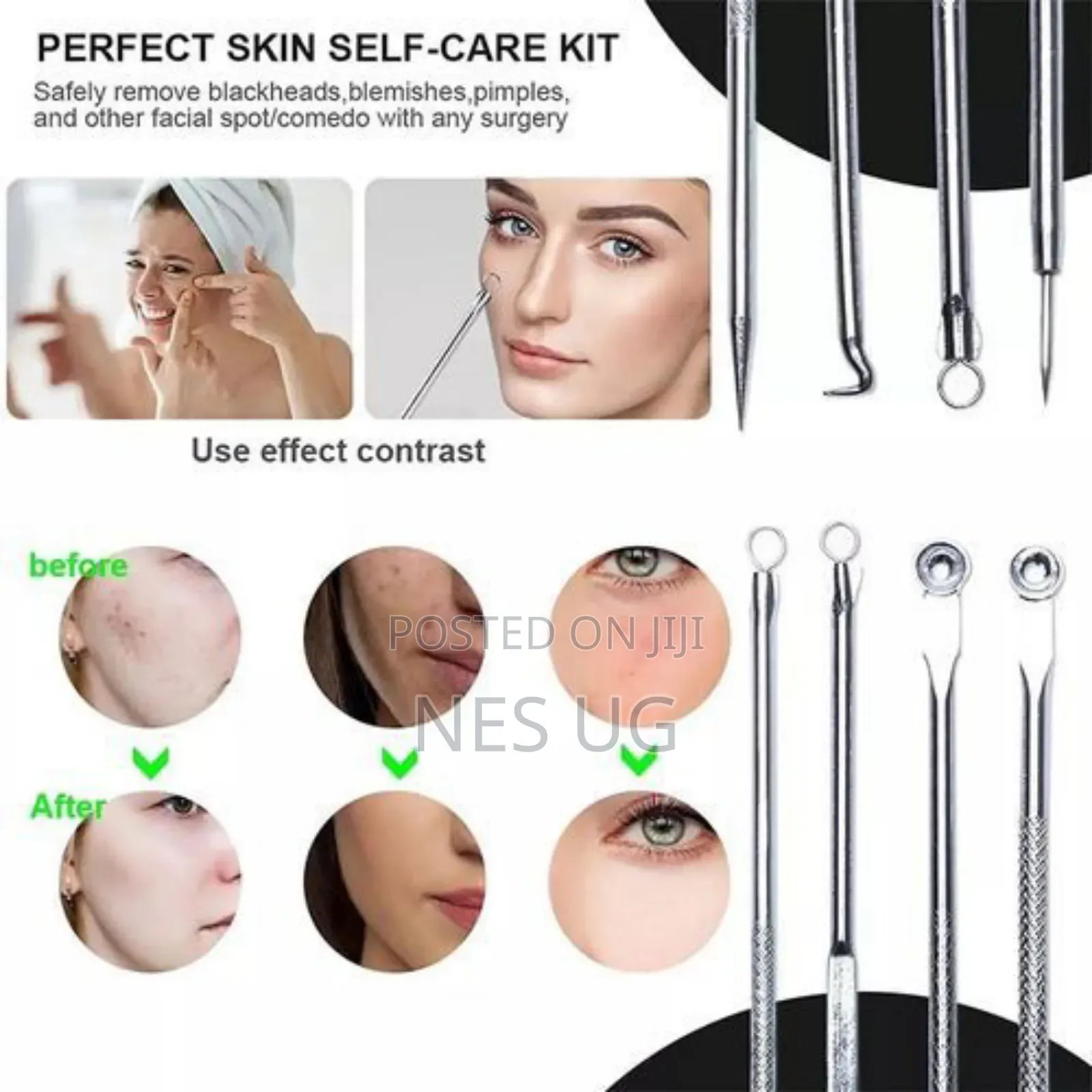 4pcs Stainless Facial Acne Remover Needles Kit Extractor Tool Set
