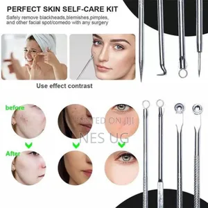 4pcs Stainless Facial Acne Remover Needles Kit Extractor Tool Set
