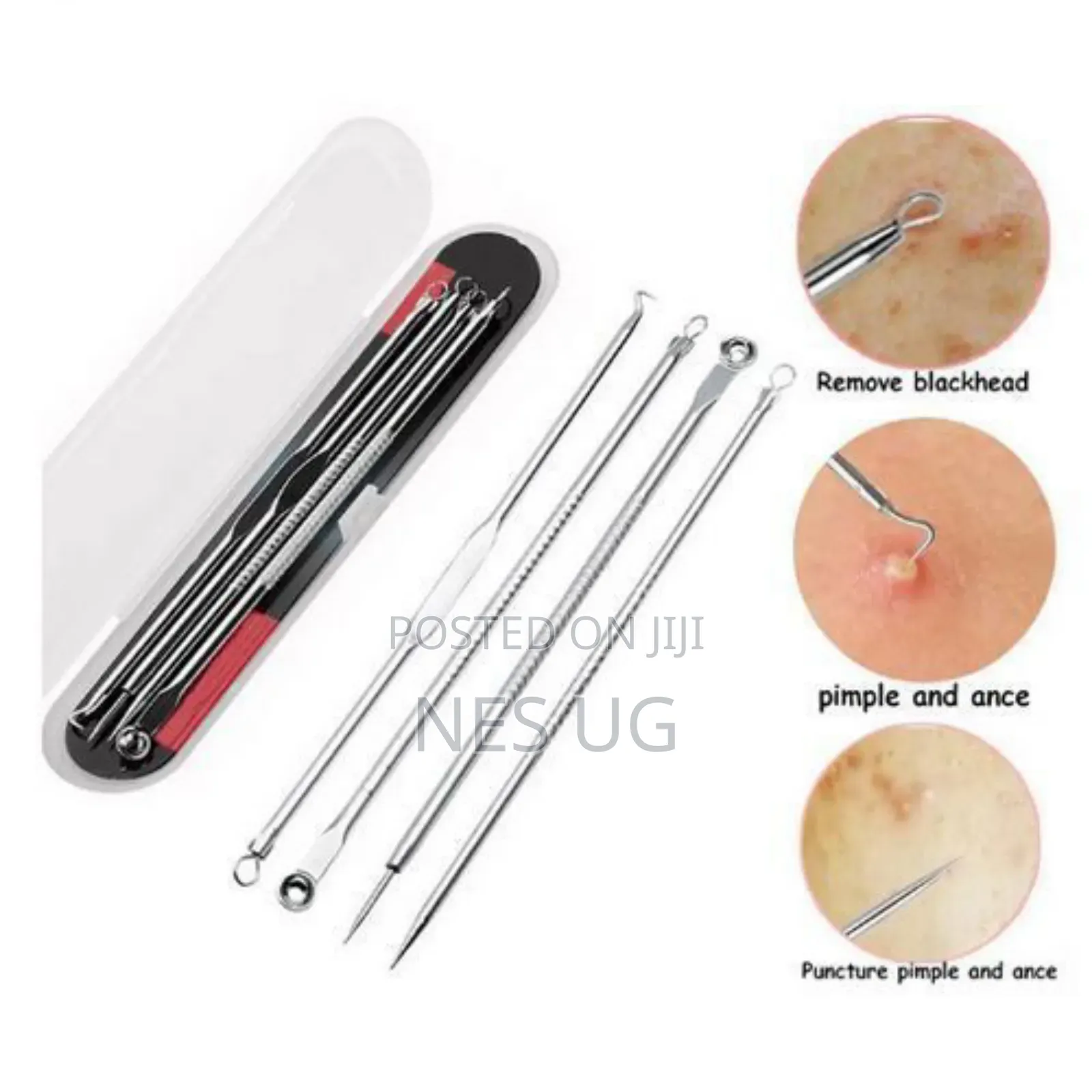 4pcs Stainless Facial Acne Remover Needles Kit Extractor Tool Set