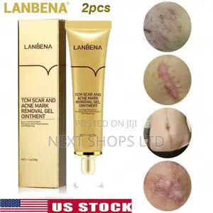Scar Remover Cream/Scar Removal/Acne Treatment/Scars Removals Cream