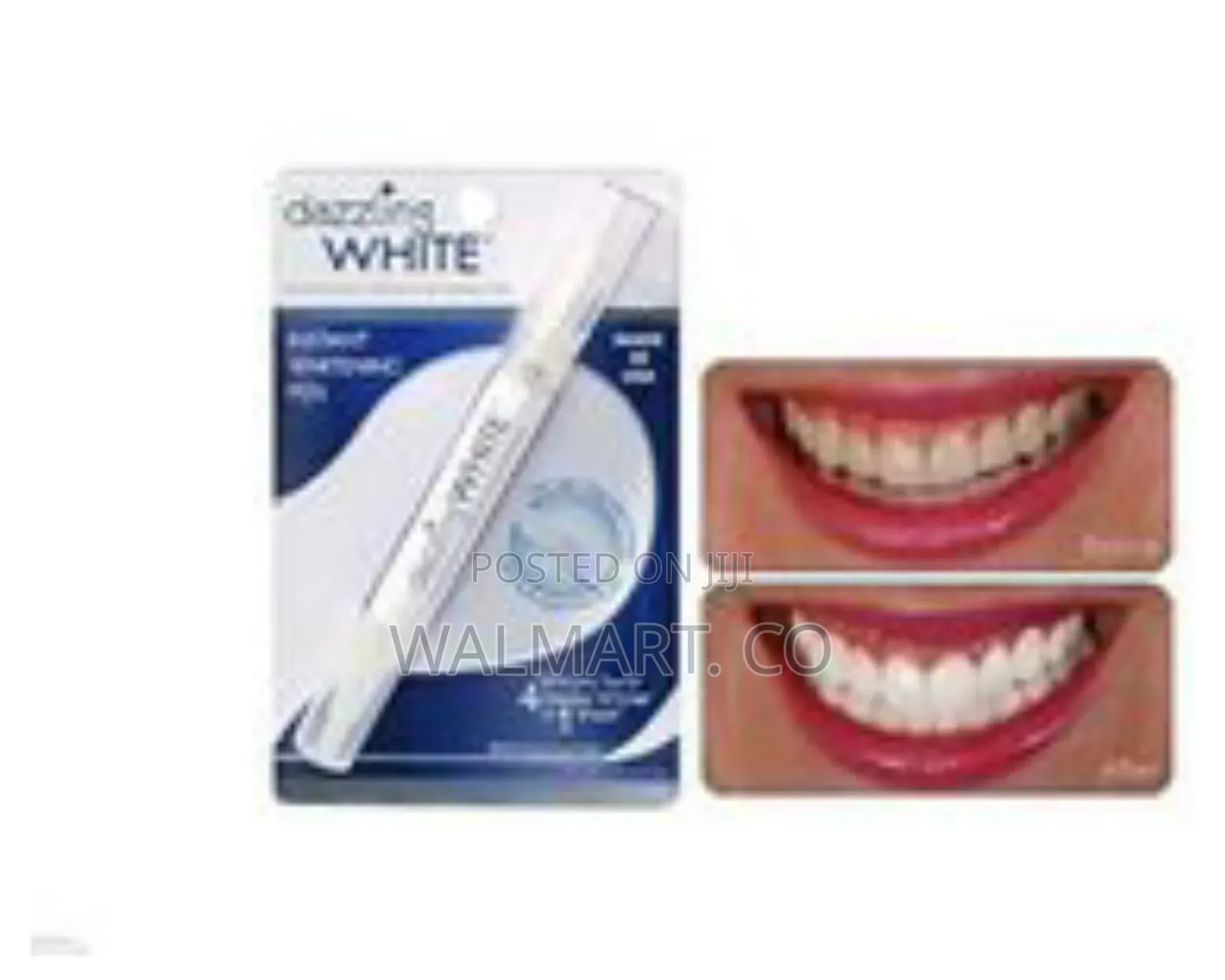 Dazzling White Instant Teeth Whitening Pen
