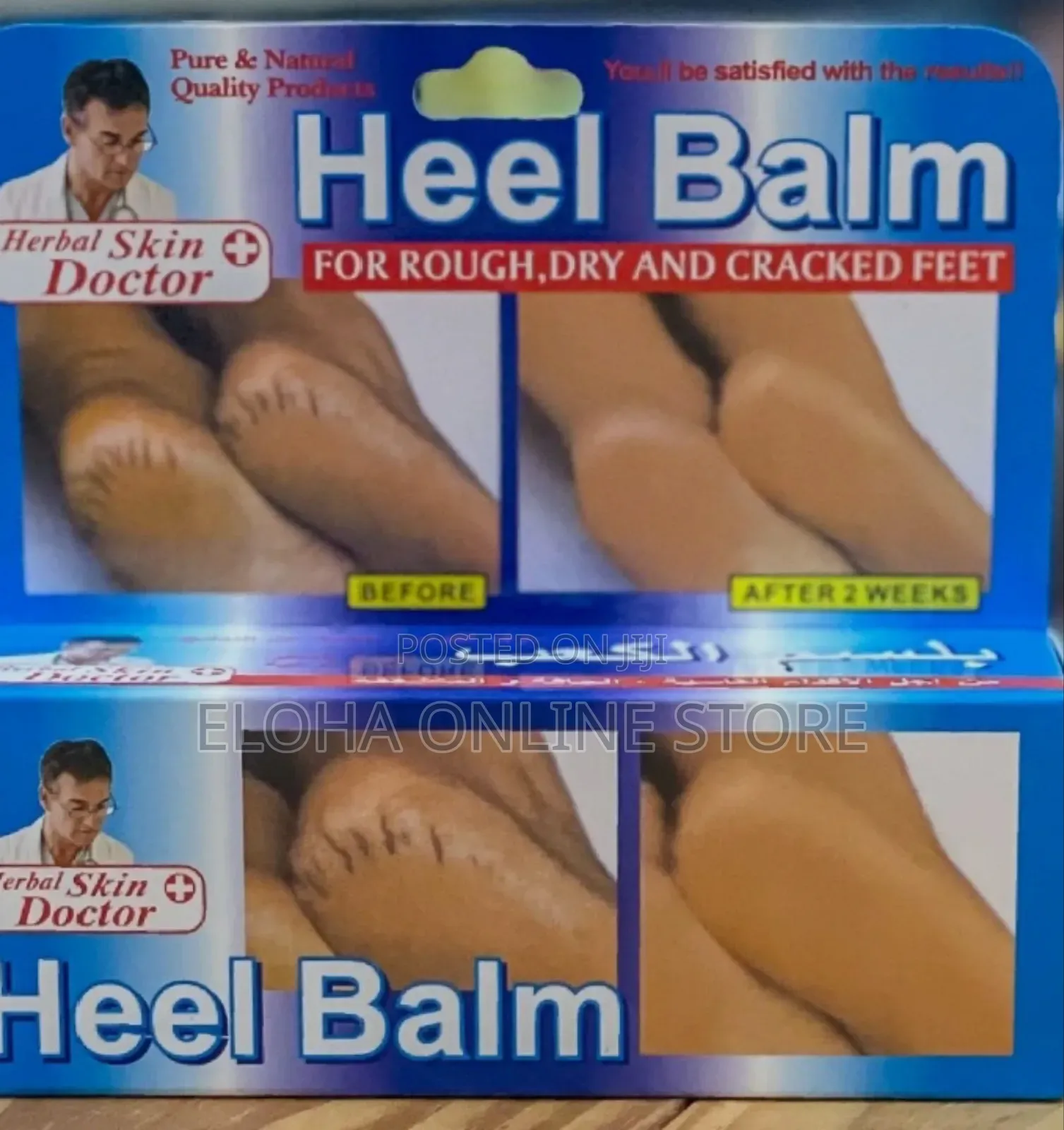 Skin Doctor Herbal Heel Balm