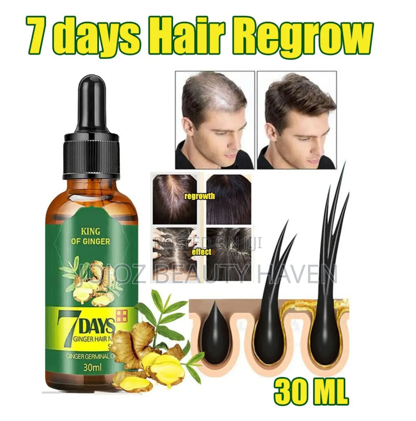 7days King of Ginger Hair Growth Organic Oil