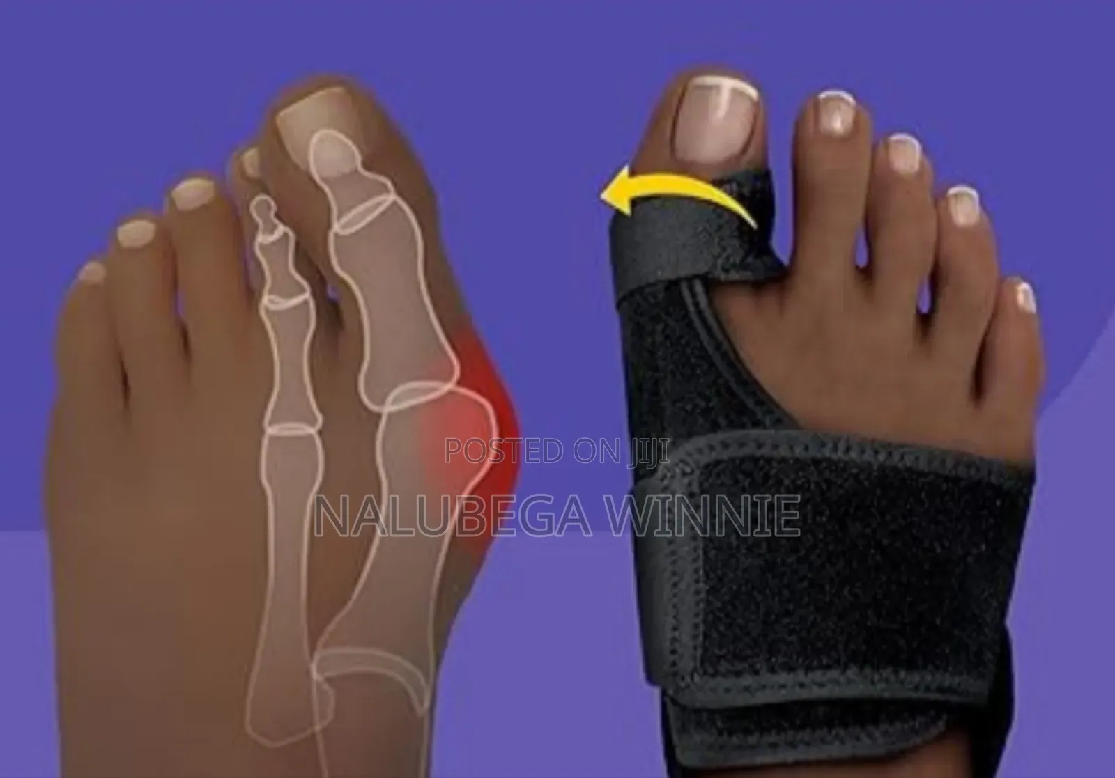 Toe Straighter