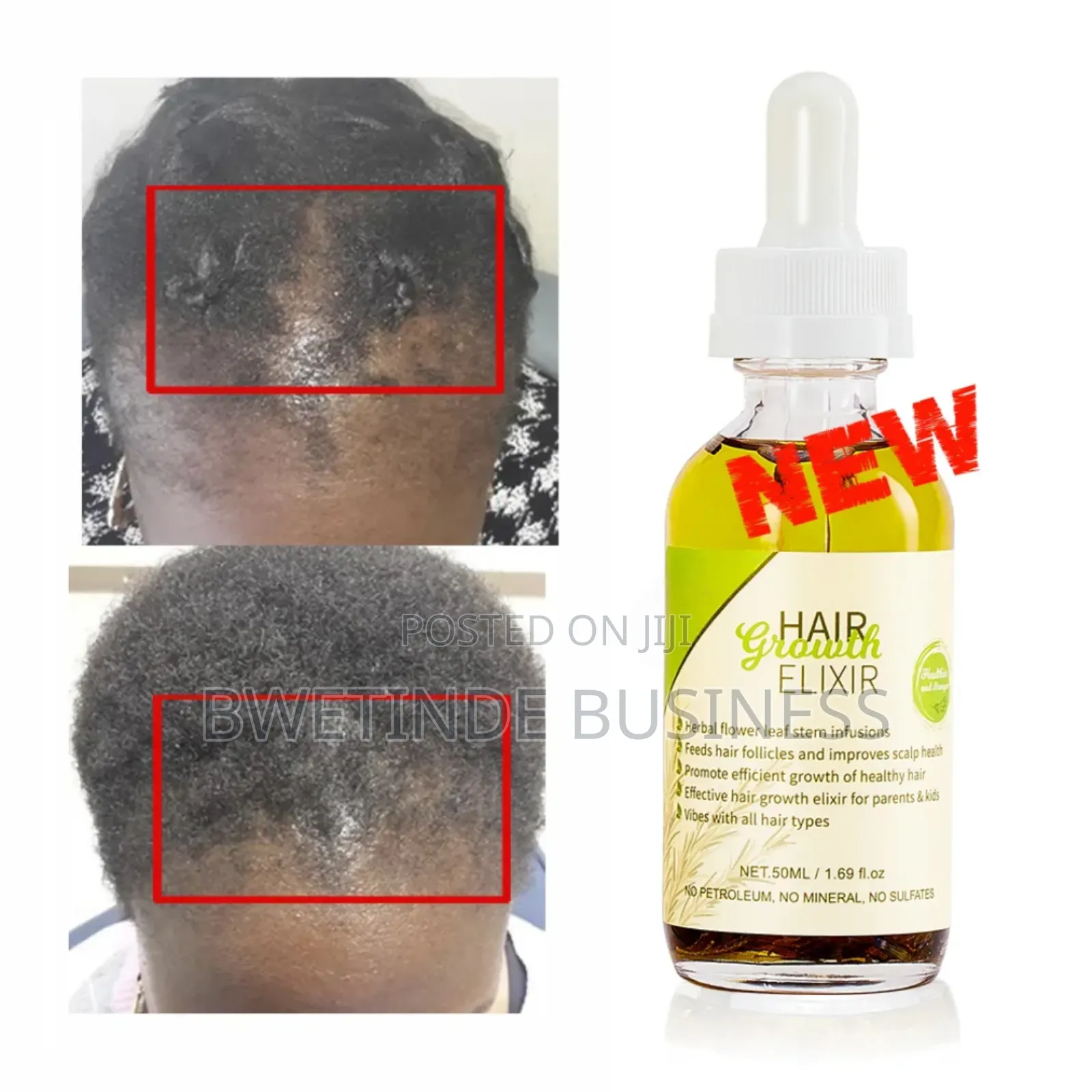 Syulli Hair Growth Elixir Oil.