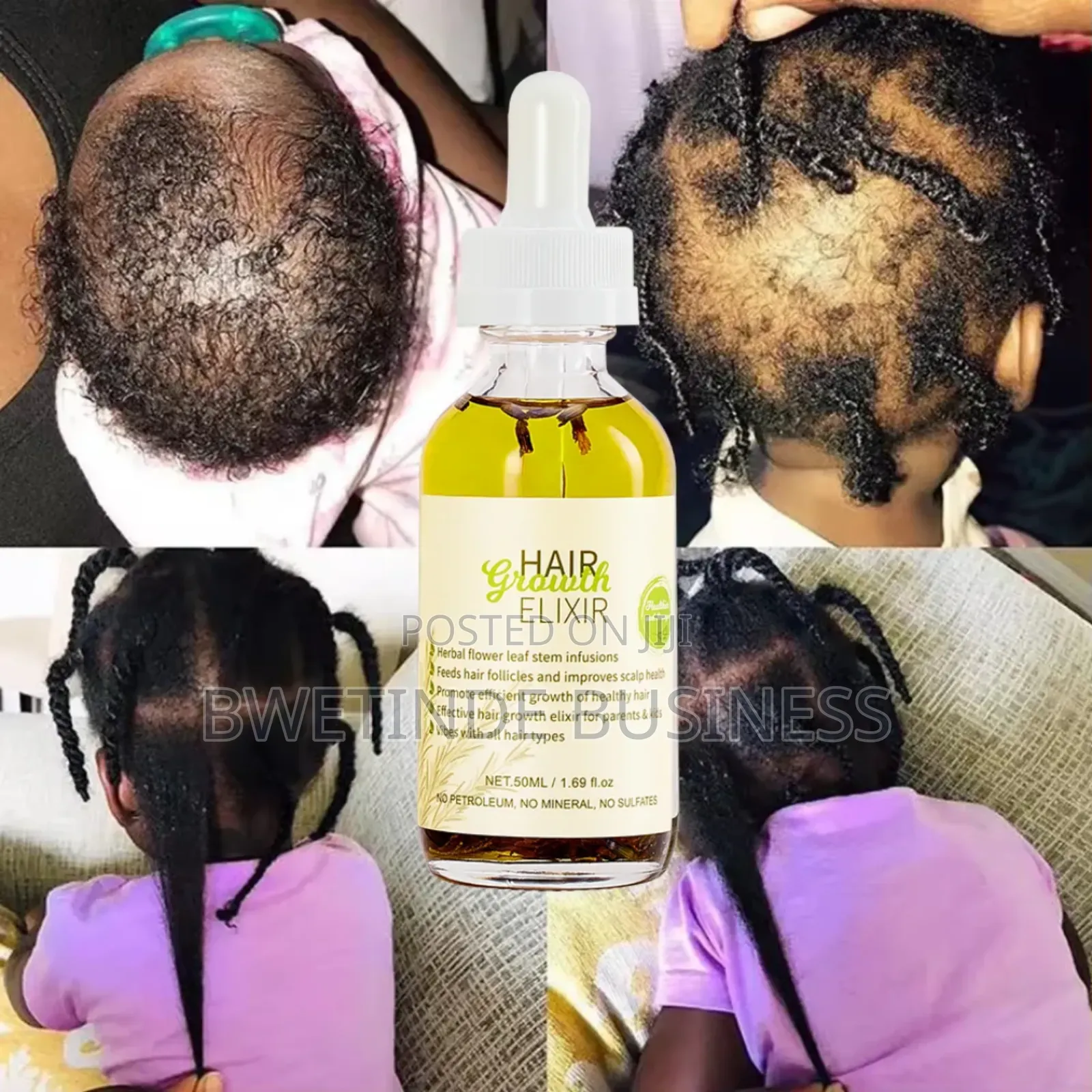 Syulli Hair Growth Elixir Oil.