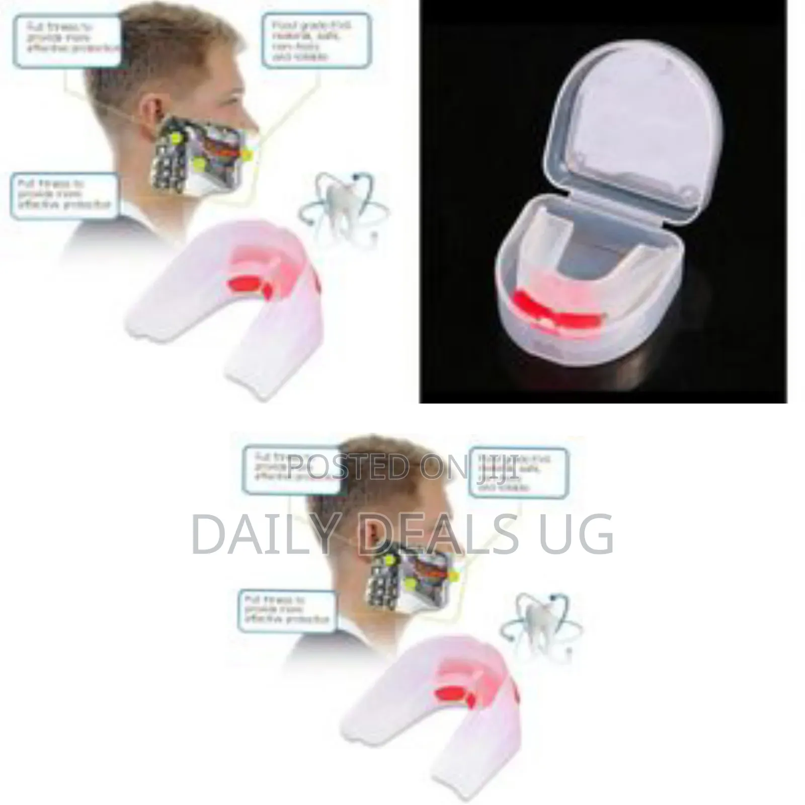 Mouth Guard