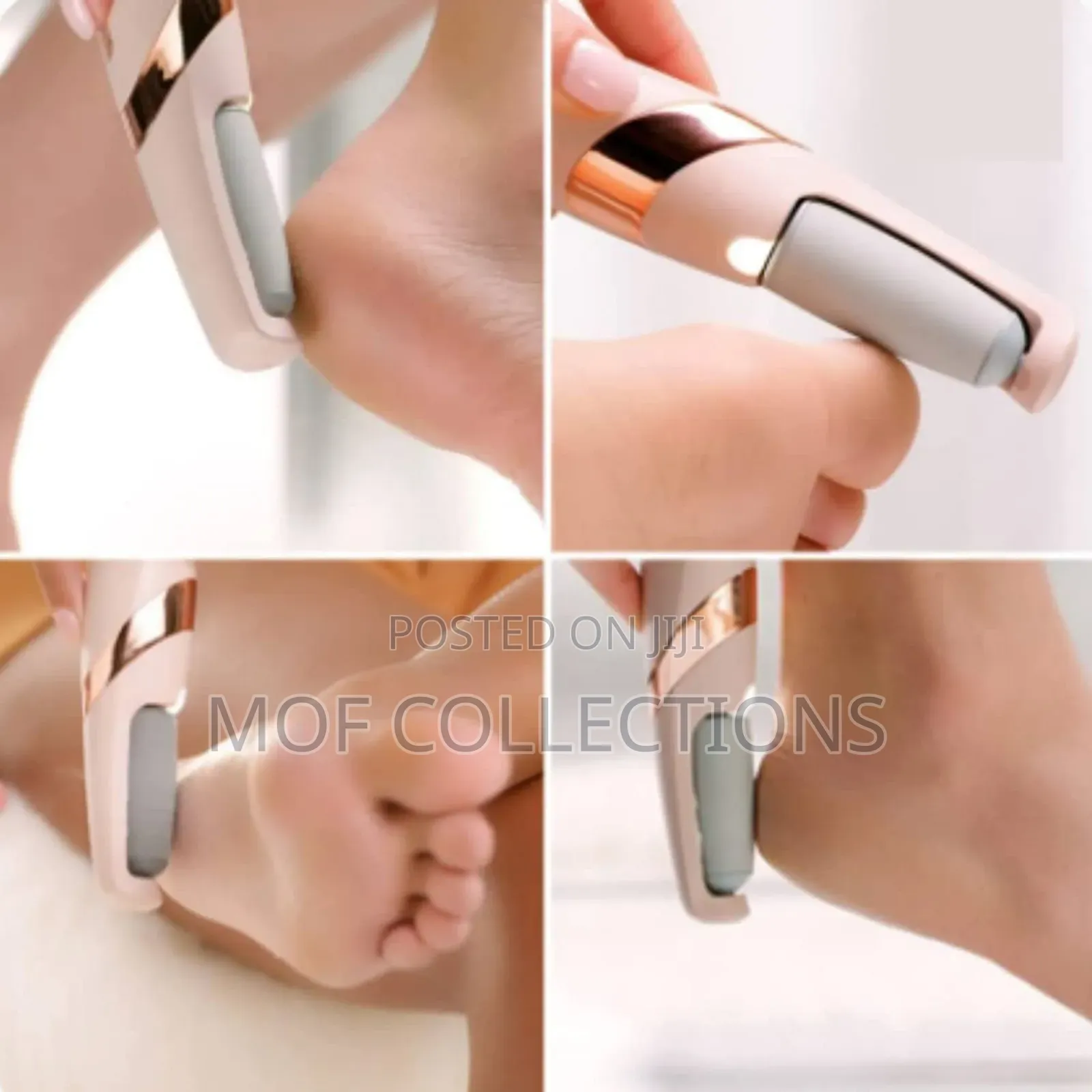 Callus Remover Foot File
