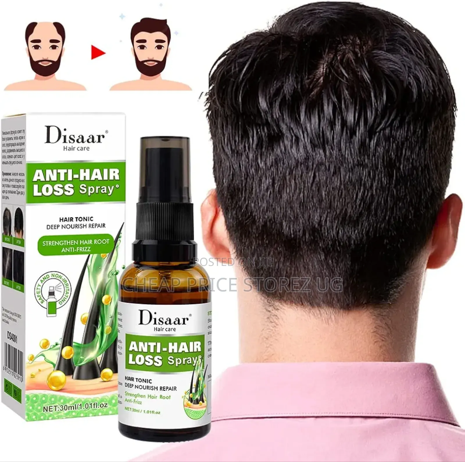 Anti Hair Loss Hair Growth Spray Essential Oil Liquid for Men Women