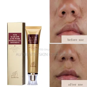 TCM Scar and Mark Removal Ointment Gel