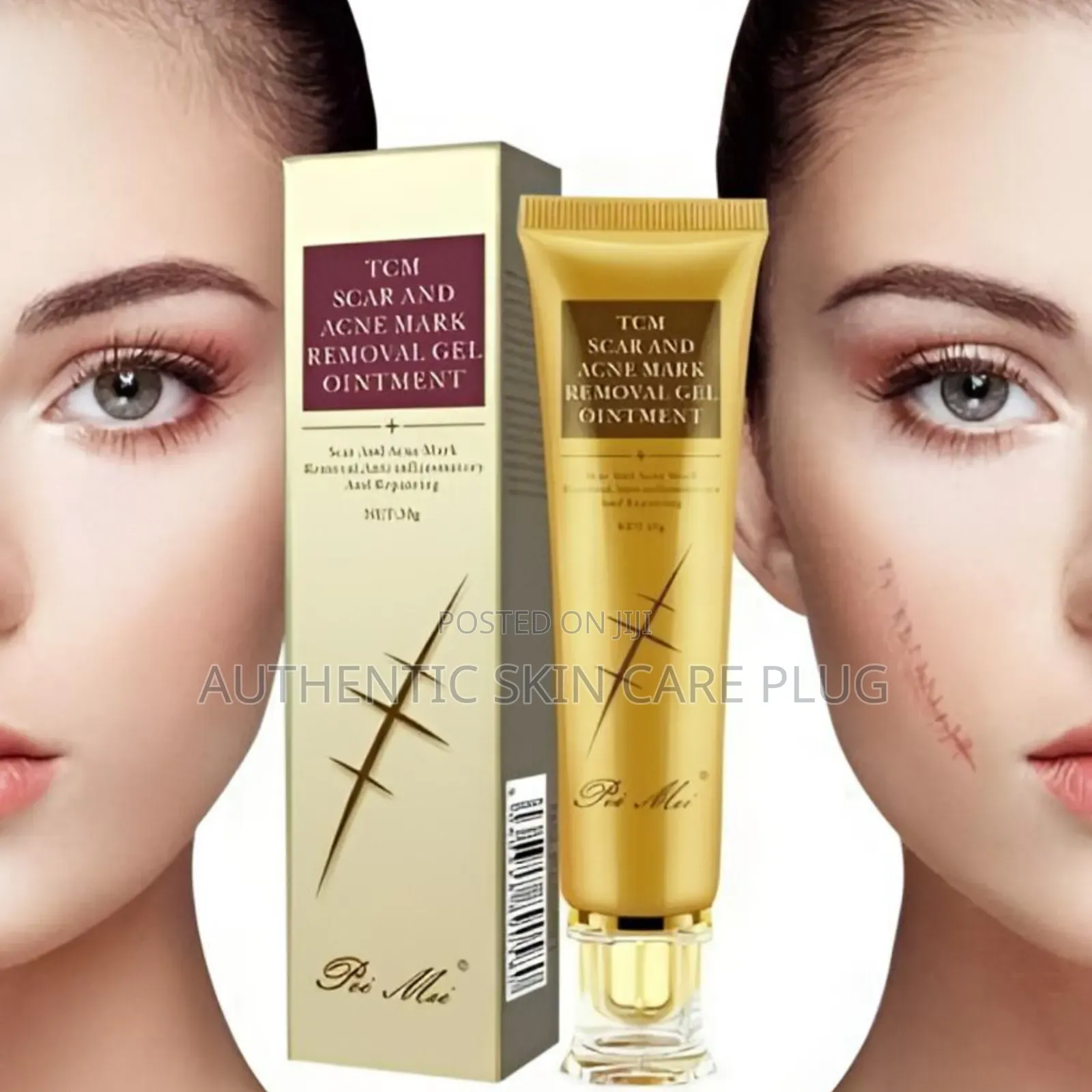 TCM Scar and Mark Removal Ointment Gel