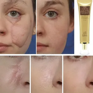 TCM Scar and Mark Removal Ointment Gel
