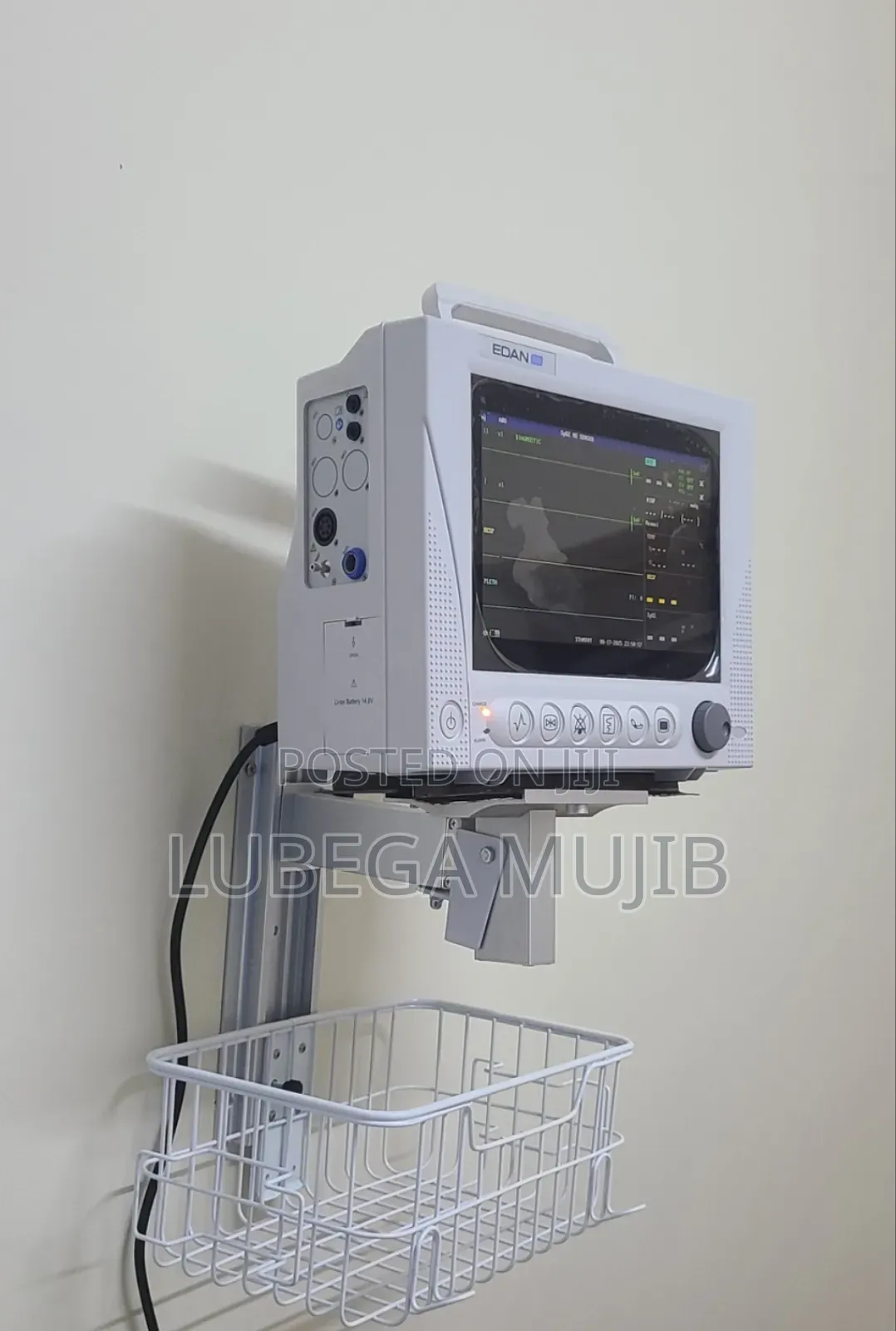 Patient Monitors With Wall Mounted Stands