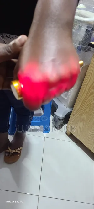 Vein Finder