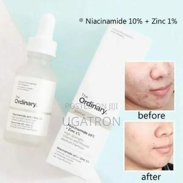 The Ordinary Niacinamide + Zinc Serum