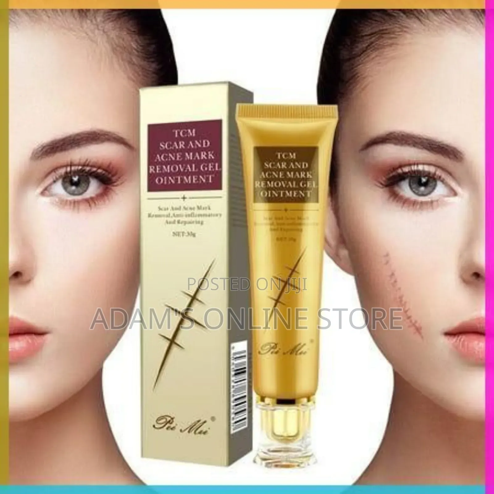 Scar Remover Cream/Scar Remover Cream