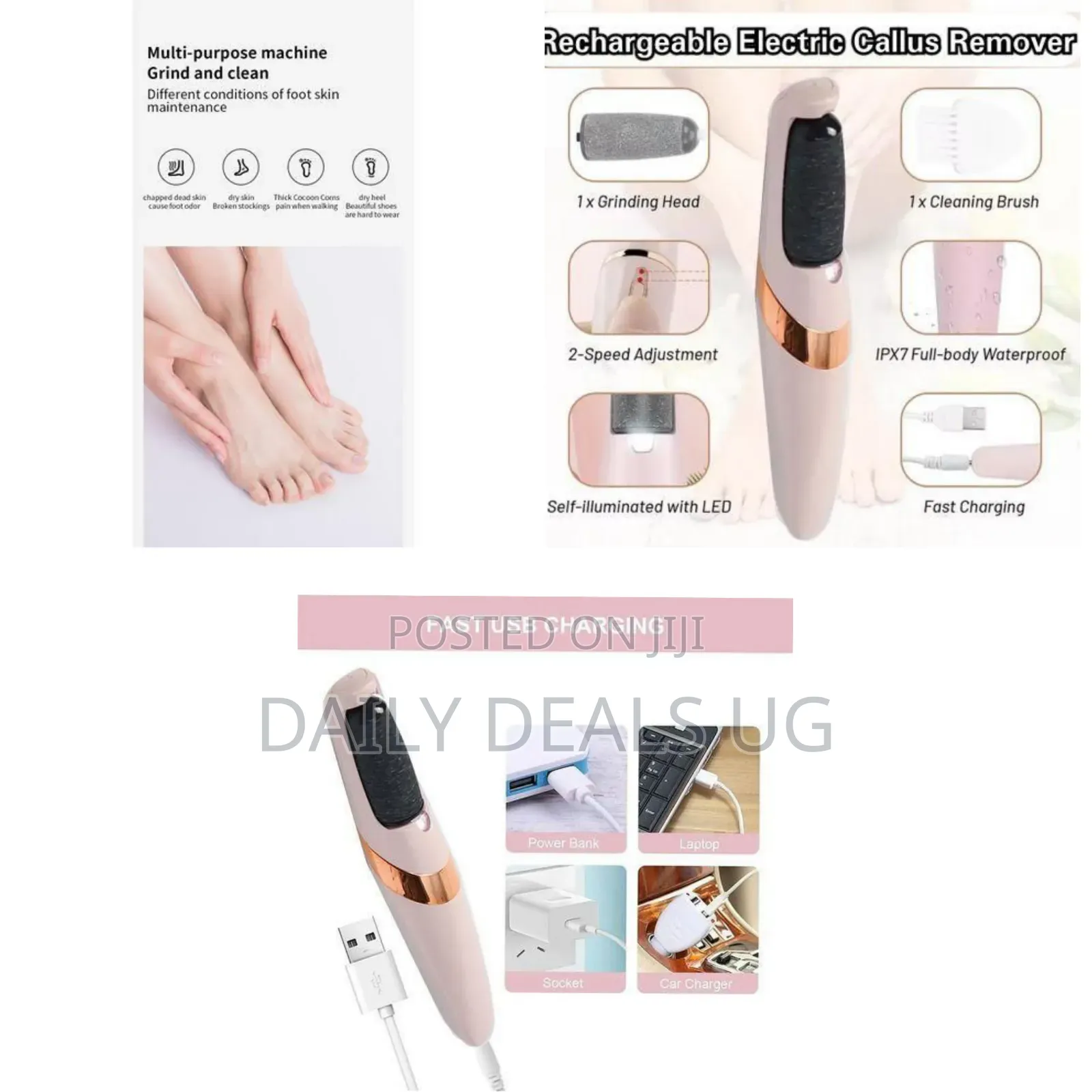 Portable Electric Foot Callus Remover for Removing Dead Skin