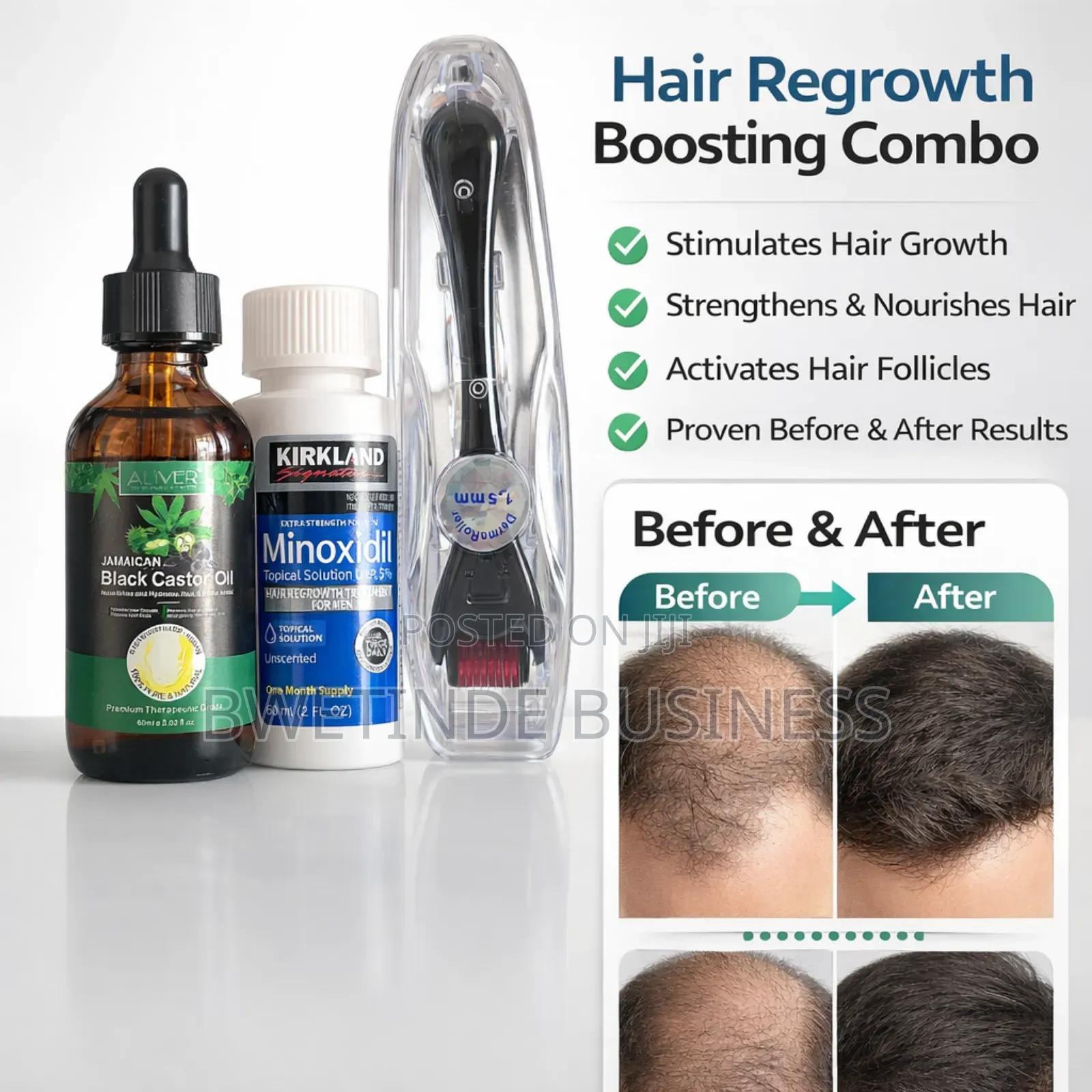 Hair Regrowth Combo: Minoxidil 5%, Castor Oil Derma Roller