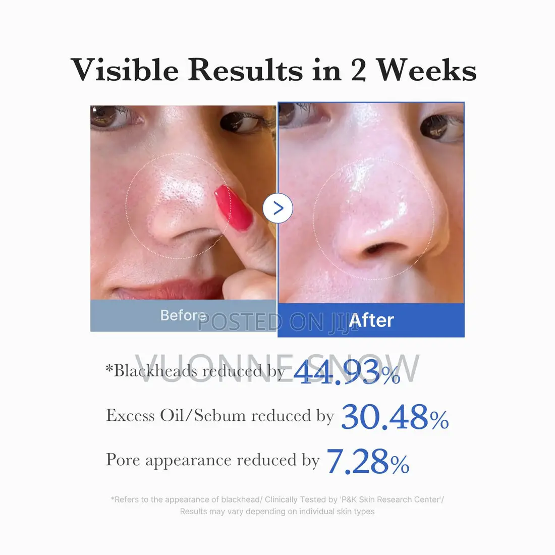 Medicube Best]Zero Pore Toning Pad 2.0