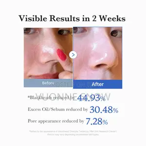 Medicube Best]Zero Pore Toning Pad 2.0