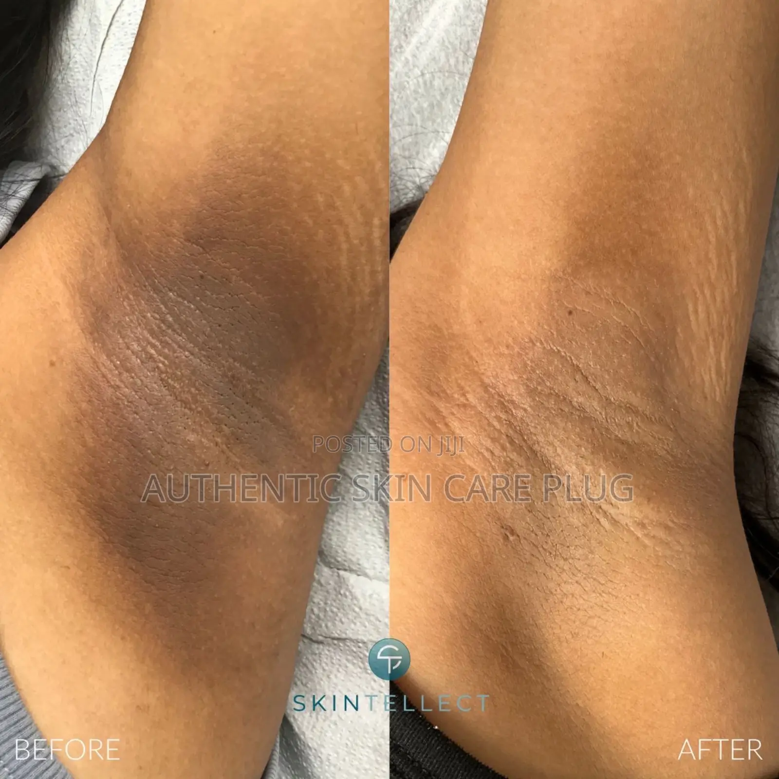 Premium Skin Lightening L-Glutathione Tablets With Alpha Arburtin